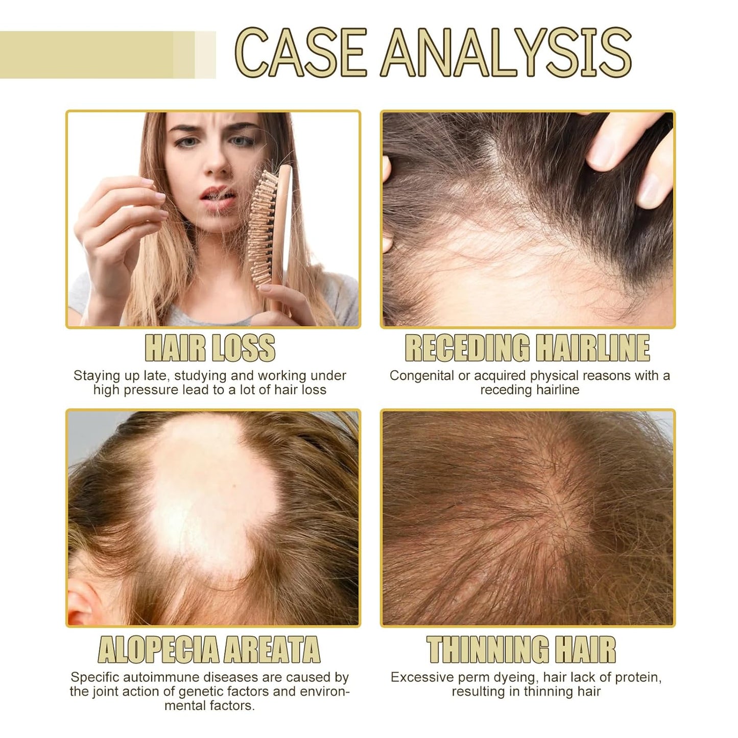 Thrive Locks™ - Hair Growth Oil 